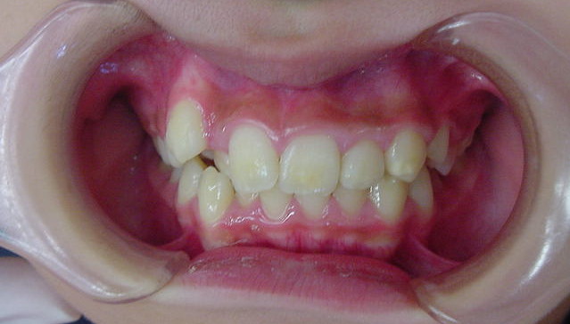 Before