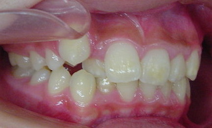 Before