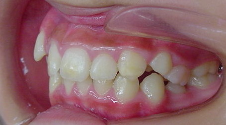 Before
