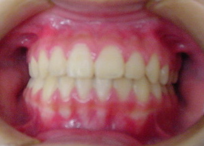 After